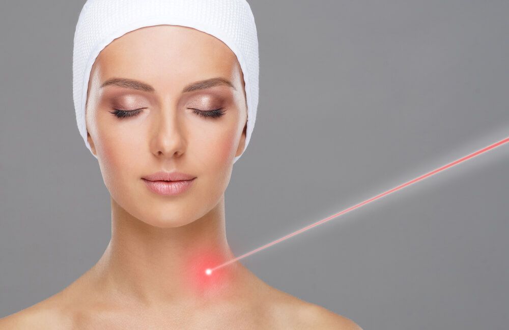 הסרת שומות בלייזר