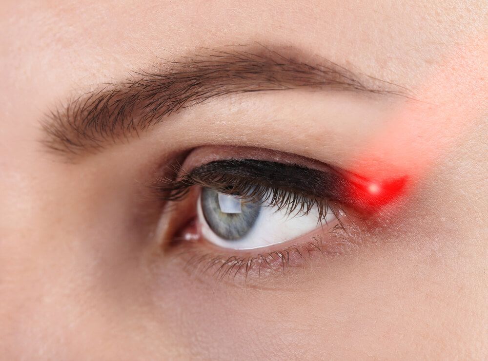 הסרת איפור קבוע בליייזר