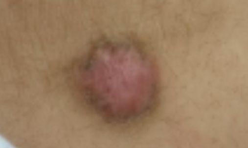 שערה הפוכה בעצם הזנב