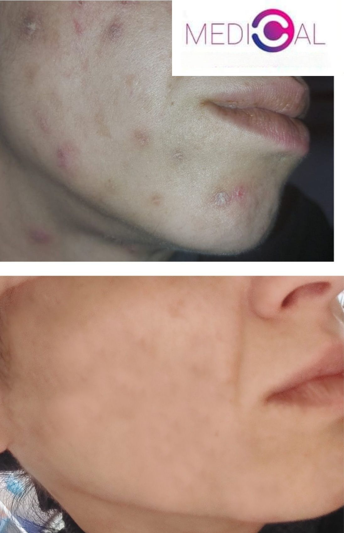 חטטים בפנים